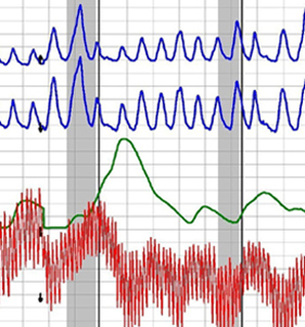 Chico polygraph test